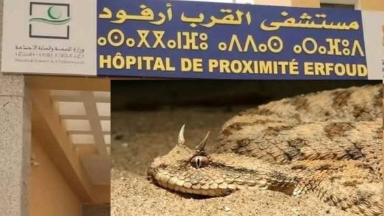 ارفود : أفعى “ذات القرنين” تودي بحياة شخص بجماعة حنابو وسط غياب مصل السمّ في مستشفى القرب