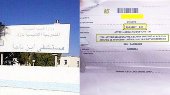 تازة : غضب بسبب موعد “سكانير” لحالة مستعجلة الى غاية سنة 2027 !!!.